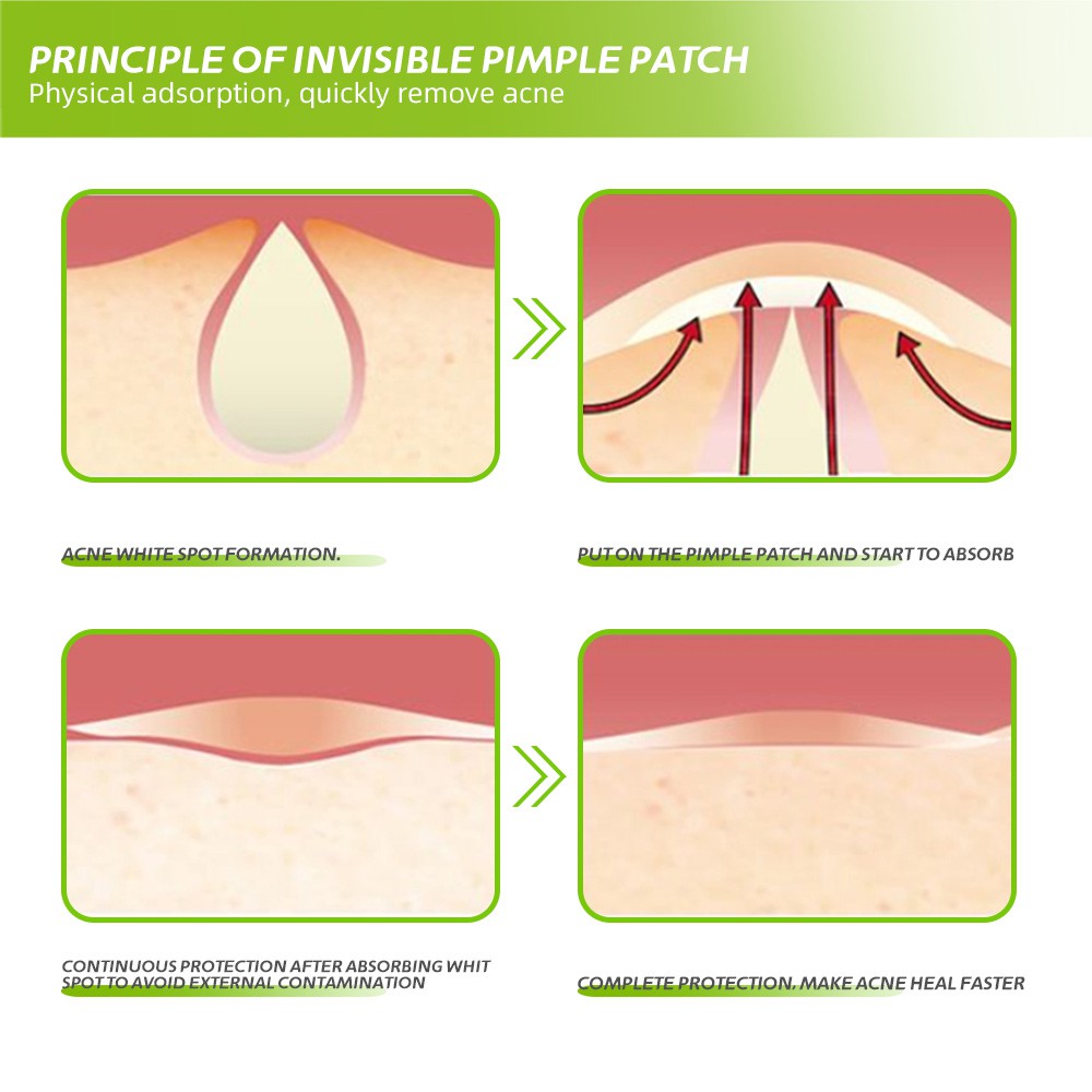 pimple stickers