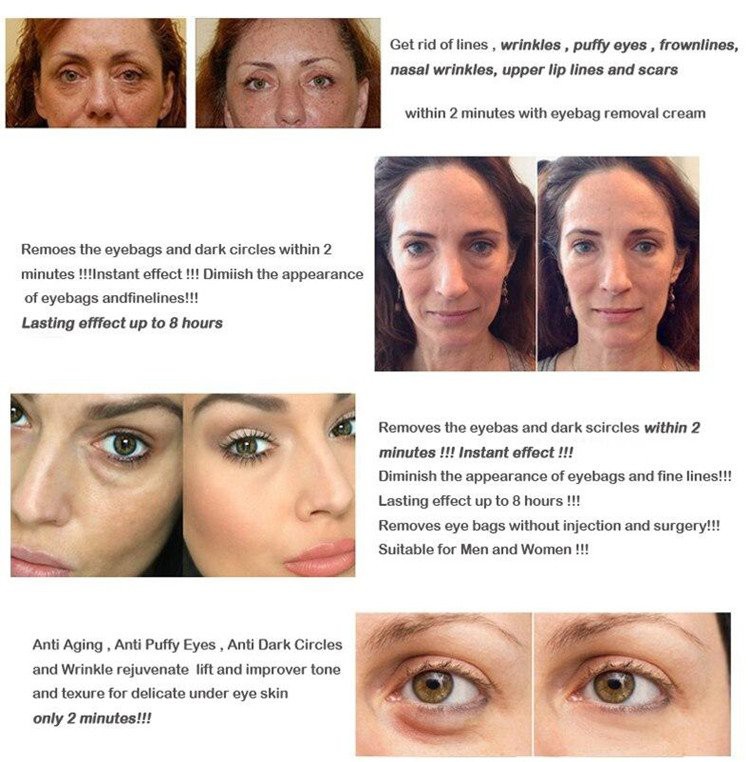 anti-aging eye cream